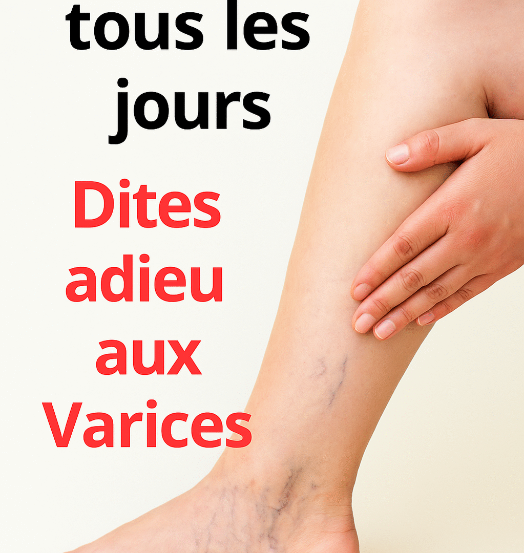 Recette naturelle varices clous de girofle