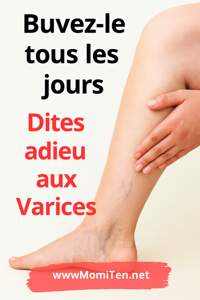 Recette naturelle varices clous de girofle