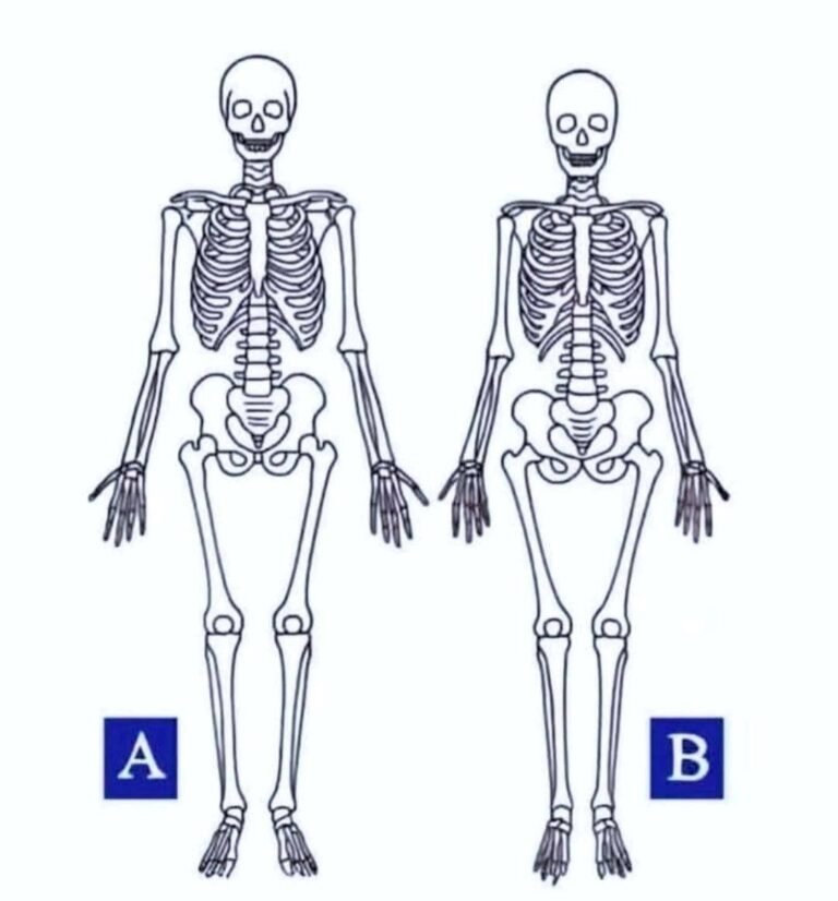 Which one is a woman???