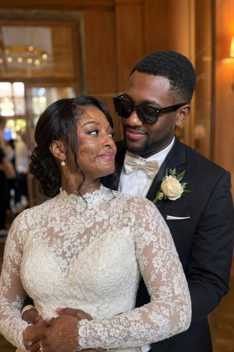 I MARRIED A BLIND MAN SO HE’D NEVER SEE MY SCARS — BUT ON OUR WEDDING NIGHT, HE WHISPERED, “THERE’S A TRUTH I’VE HIDDEN FOR 20 YEARS.”
