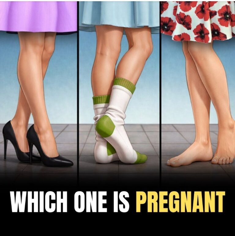 Which one is pregnant