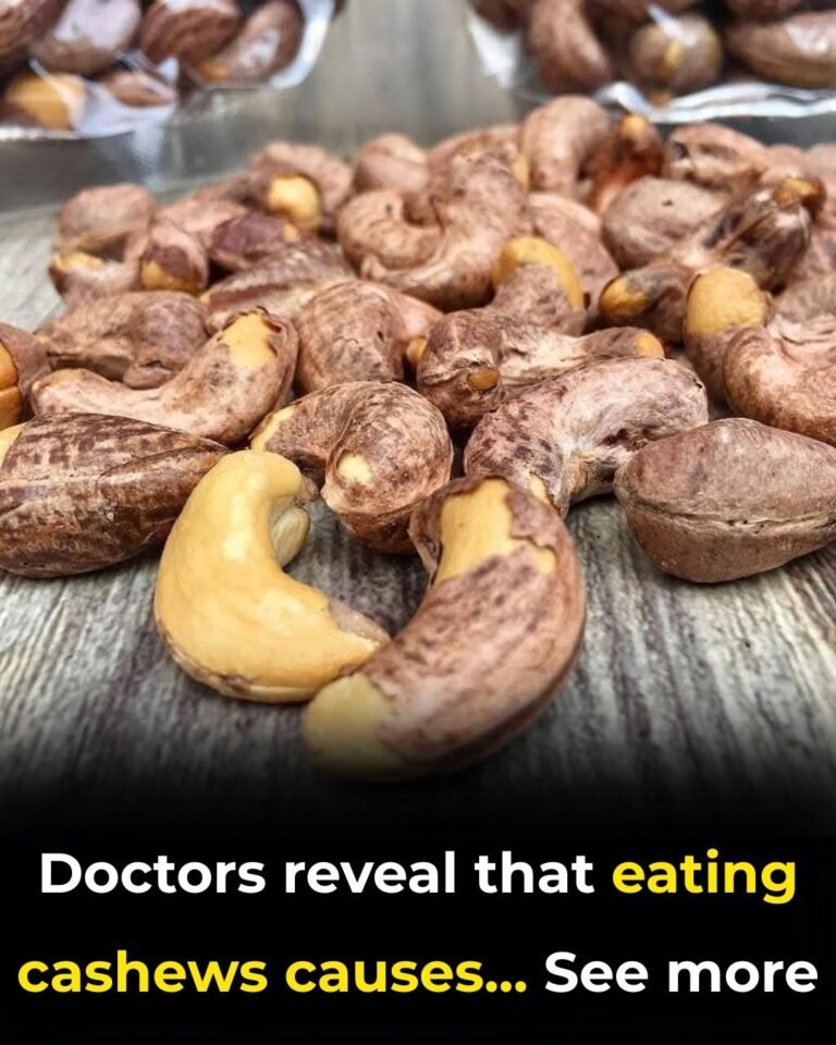 Doctors Reveal: What Eating Cashews Actually Does to Your Body (Science-Backed Benefits)