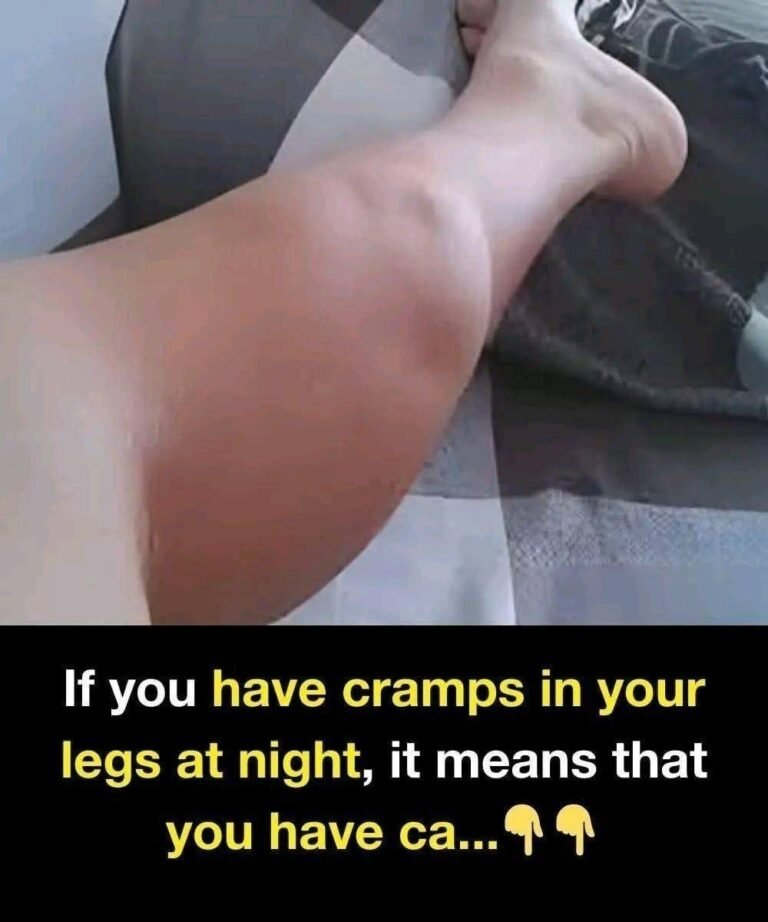 Who Is Most at Risk of Night Cramps? A Simple, Science-Backed Guide to Prevention