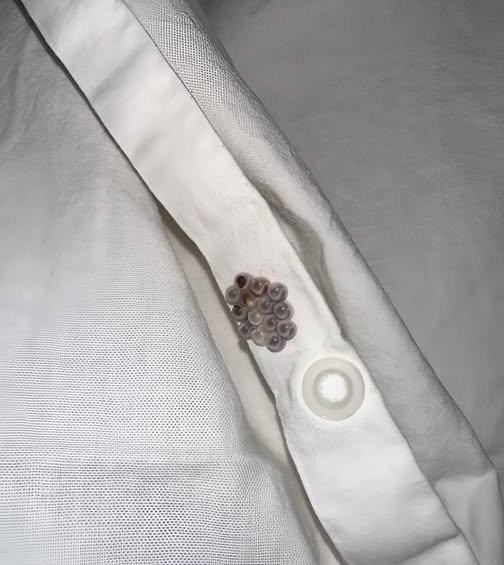Those Tiny Balls in Your Bed? Here’s What They Really Are (And Why It’s Probably NOT Stink Bug Eggs)