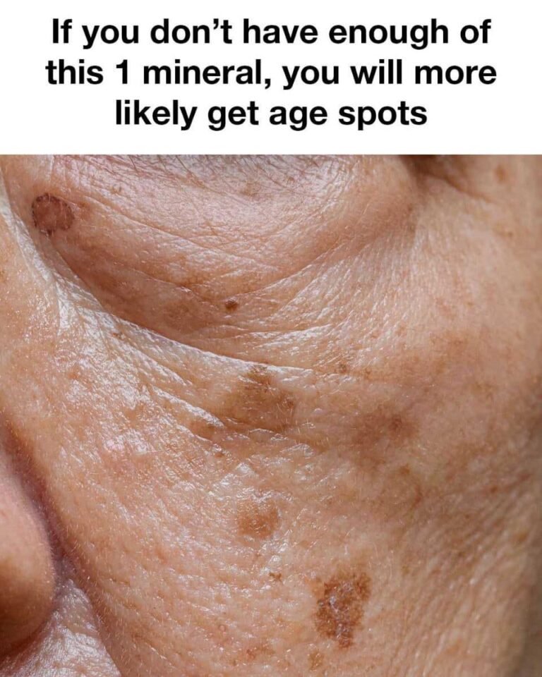 I Learned Something New: The Mineral That Helps Fade Age Spots Naturally
