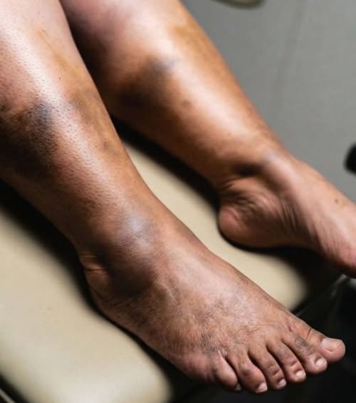 These Are the Consequences of Sleeping with Someone Who Has HPV – What You Need to Know